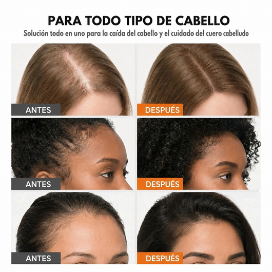 Il siero per la crescita dei capelli numero 1 in Corea