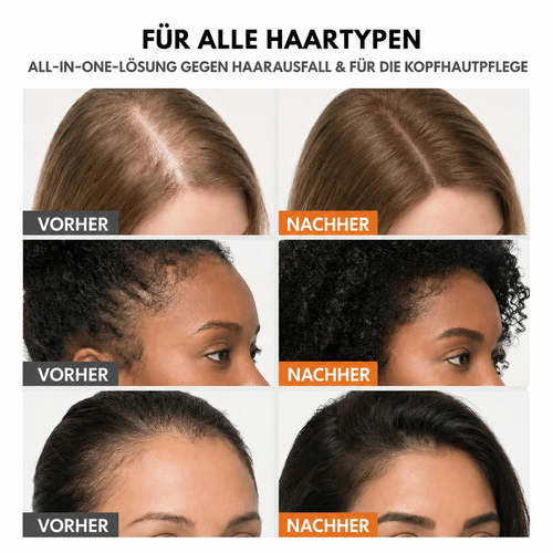 Koreas Haarwuchs-Serum Nr. 1